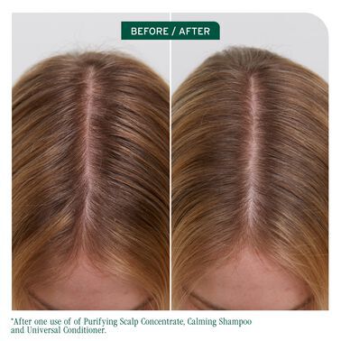 Scalp Sync Universal Conditioner - Biolage Renovation NZ | L'Oréal Partner Shop